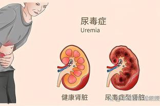 利拉德谈质疑：有时候你看不到隧道尽头的光 但要对自己有信心